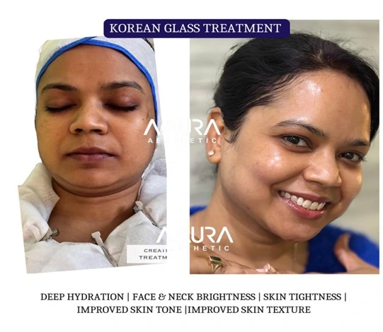 glow facial treatment in lucknow