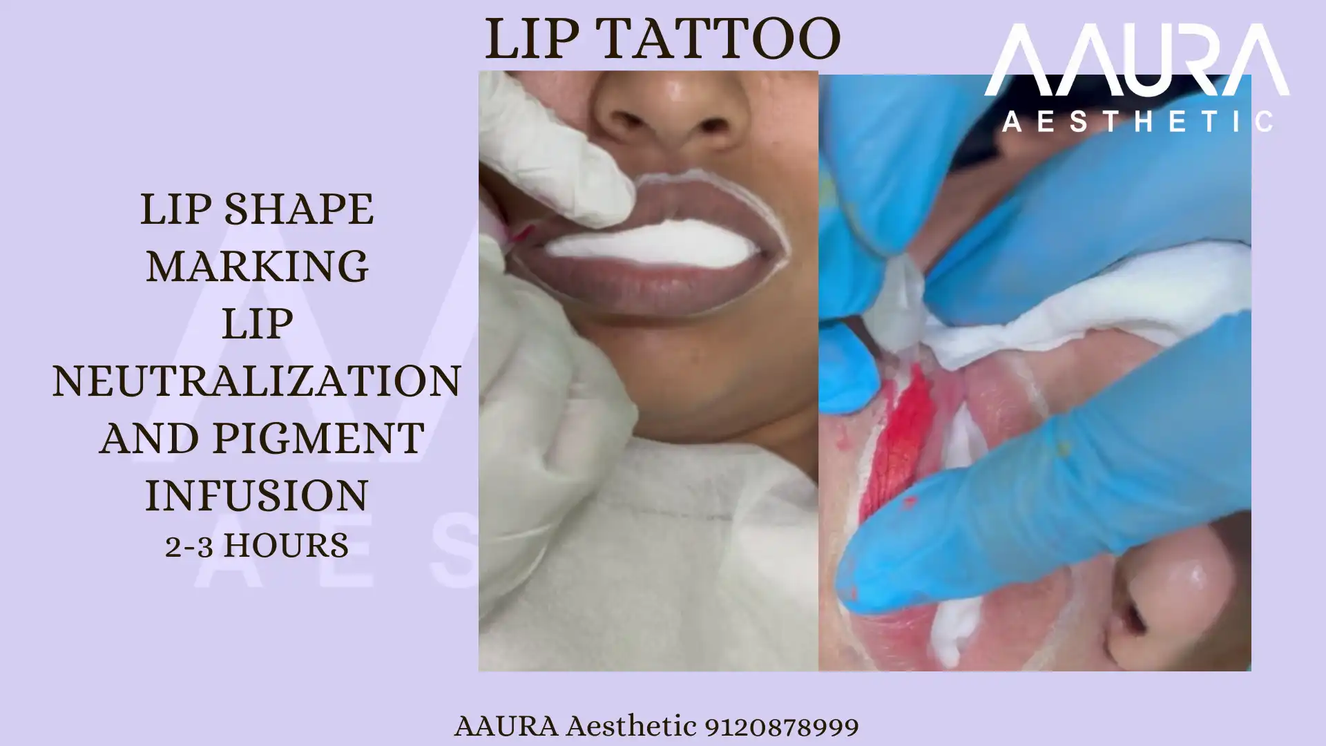 Skin Therapy And Treatment